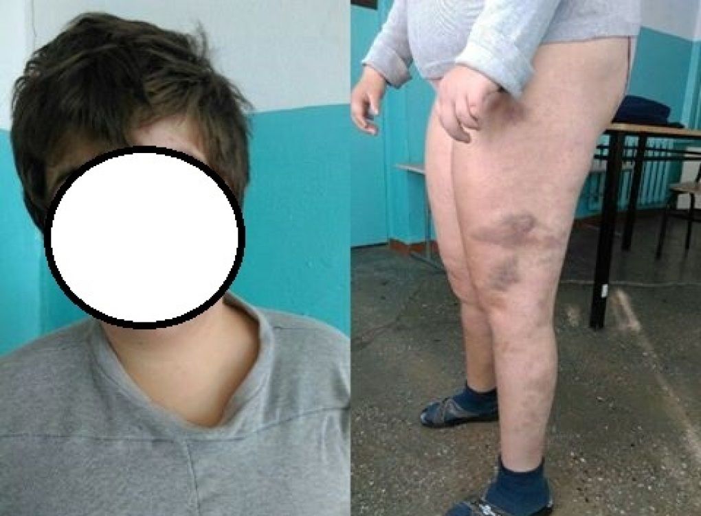 Incidentul de la Spitalul Clinic de Psihiatrie va fi analizat de un grup de lucru creat de Ministerul Sănătății.