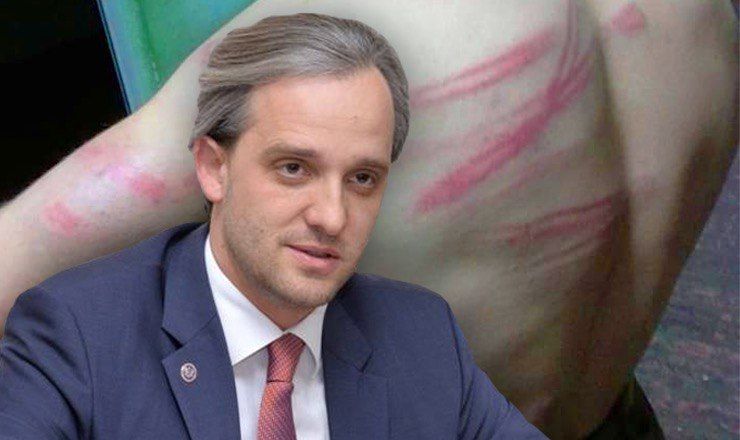 Министр обороны прокомментировал избиение солдат.