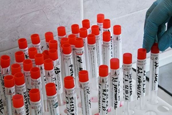 Врачам больницы в Бессарабке проводят тестирование на COVID-19.