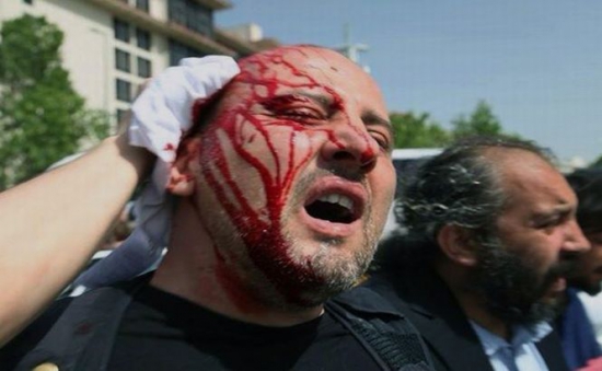 Cele mai multe persoane (535), care au avut nevoie de îngrijiri medicale, au fost înregistrate în spitalele din Istanbul. 