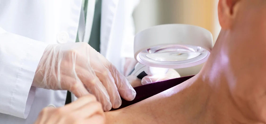 Premieră medicală la Institutul Oncologic: O nouă tehnică pentru tratarea cancerului de piele.