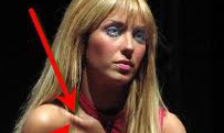 Acum Anahi încearcă să îşi revină şi să ajungă la o greutate normală pentru vârsta şi înălţimea ei.