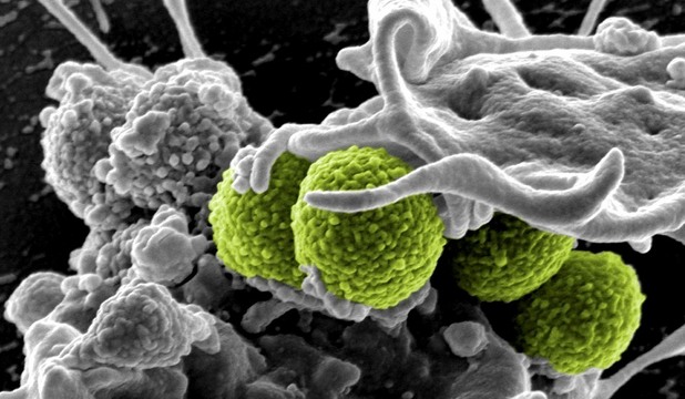 Cercetătorii americani care au realizat studiul au folosit doze foarte mari de vitamina B3