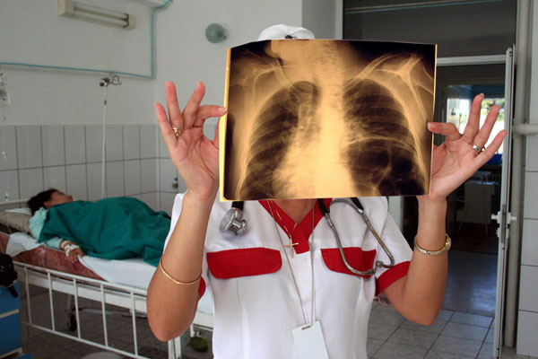 Bolnavii de tuberculoză care refuză să se trateze vor fi spitalizaţi forţat.