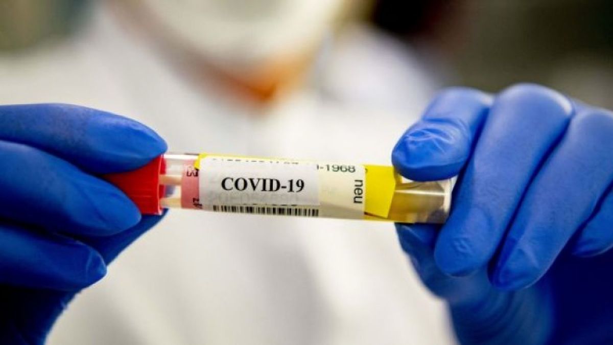 На молдавских пациентах, инфицированных COVID-19, будут тестировать 2 препарата. 