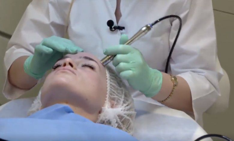 Microdermabraziunea cu diamante. Ce beneficii are pentru ten