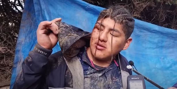 Боливиец, похороненный заживо по ошибке, смог выбраться из гроба.