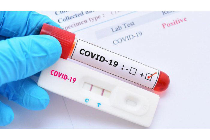 Более 60 случаев COVID-19 зарегистрировано в Кишиневе.