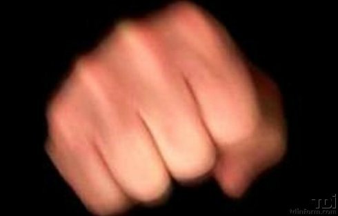 Инцидент произошел еще 11 сентября, но женщина обратилась к медикам лишь спустя три дня.