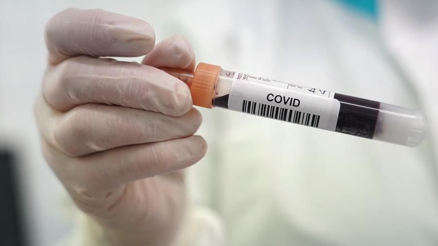 В Молдове зарегистрирован 71 новый случай COVID-19.