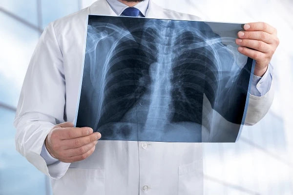 Un tânăr, diagnosticat greșit la un spital din România, trebuie să primească daune de un milion de euro.