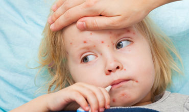 Ministerul Sănătății îngrijorat de răspândirea epidemică a rujeolei în România.