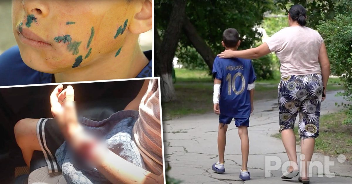 В Пелинии на ребенка напала соседская собака: он госпитализирован.