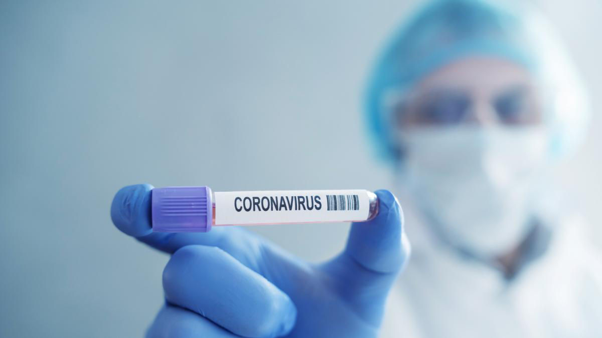 За последнюю неделю зарегистрировано более 3 800 случаев заражения COVID-19.