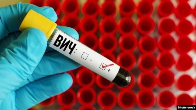 Ученые нашли способ защиты от ВИЧ благодаря червям-паразитам.