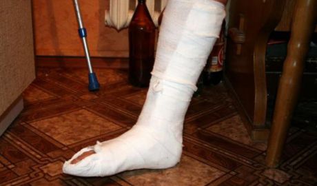 25-летняя сотрудница одного из предприятий Бельц сломала обе ноги на рабочем месте.
