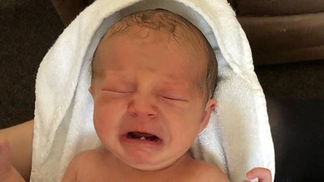 Зубы у новорожденных (или натальные зубы) встречаются редко: примерно один случай на несколько тысяч новорожденных. 