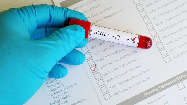 Peste 180 de persoane au murit în Ucraina din cauza virusului H1N1. Foto: insidetoronto.com