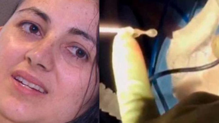 Tulburător! Medicii au înlemnit. Ce i-au găsit în cutia craniană, Foto: publika.md