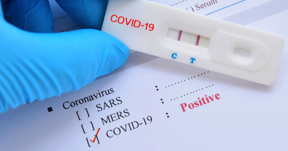 Количество случаев COVID-19 в Молдове выросло на 52% за неделю.