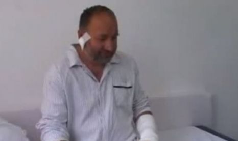 "M-a muşcat, am răni peste tot, în special pe mâna stângă, de unde m-a prins de trei ori", a povestit Blazo.