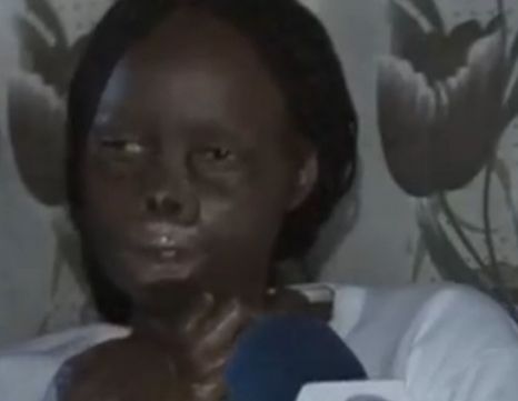 Povestea tragică a unei femei din Kenya face înconjurul lumii după ce a trecut prin momente cruciale alături de soţul ei care a mutilat-o din cauză că era prea frumoasă.