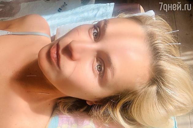 Полина Гагарина согласилась на экстремальное лечение.