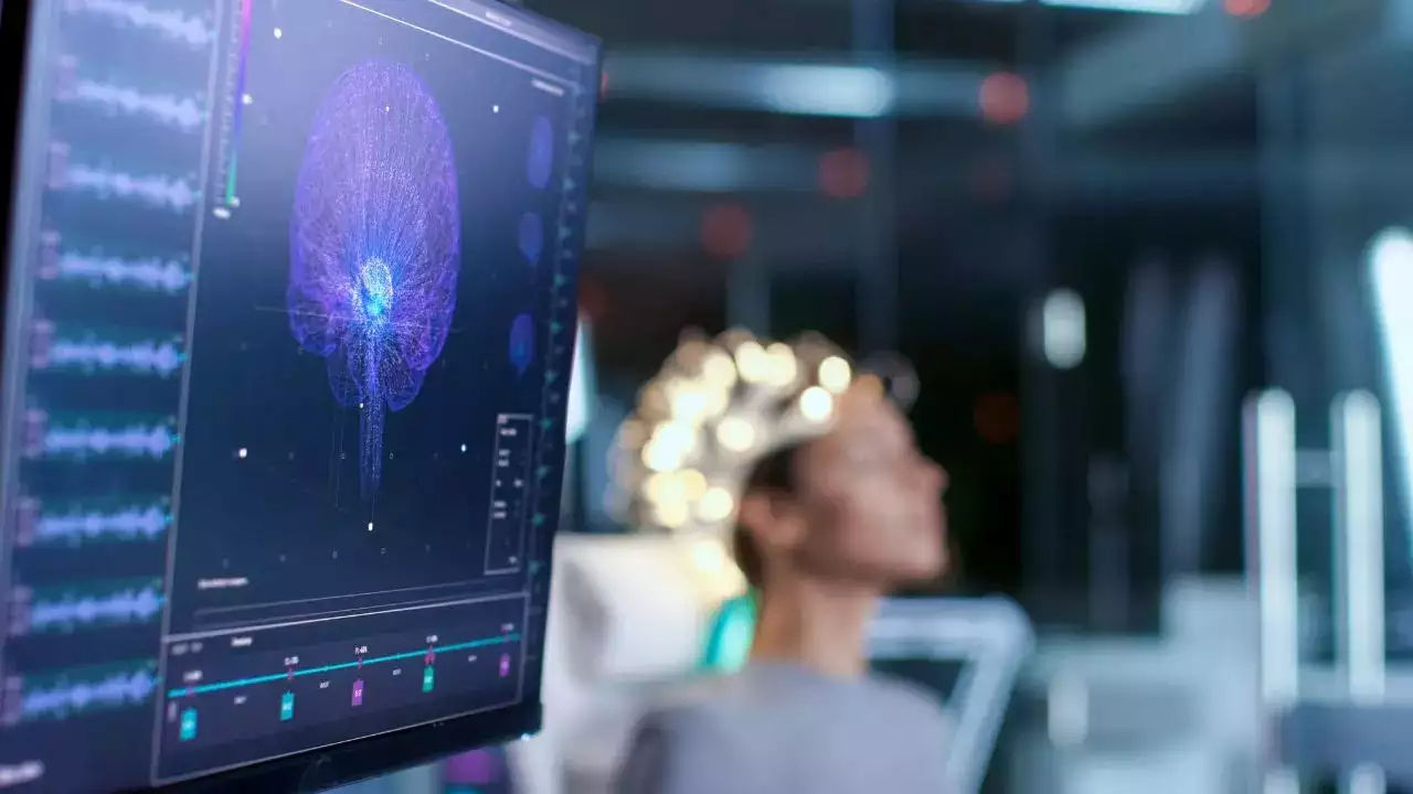 Reuters: Neuralink Маска годами имела проблемы со своими имплантами.