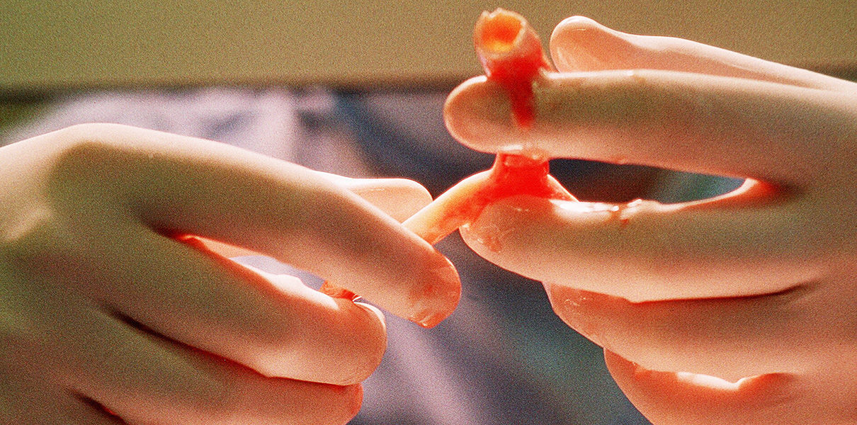 Напечатанные на 3D-принтере кровеносные сосуды прижились за 7 дней.
