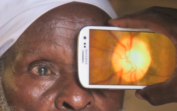 Peek poate diagnostica orbirea, cataracta, glaucomul, degenerarea maculara, retinopatia diabetica dar si alte boli ale retinei sau ale nervului optic.