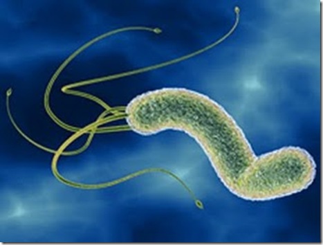 Helicobacter pylori способна снизить чувствительность иммунитета, тем самым, ограждая человека от склероза. Фото: medside.ru