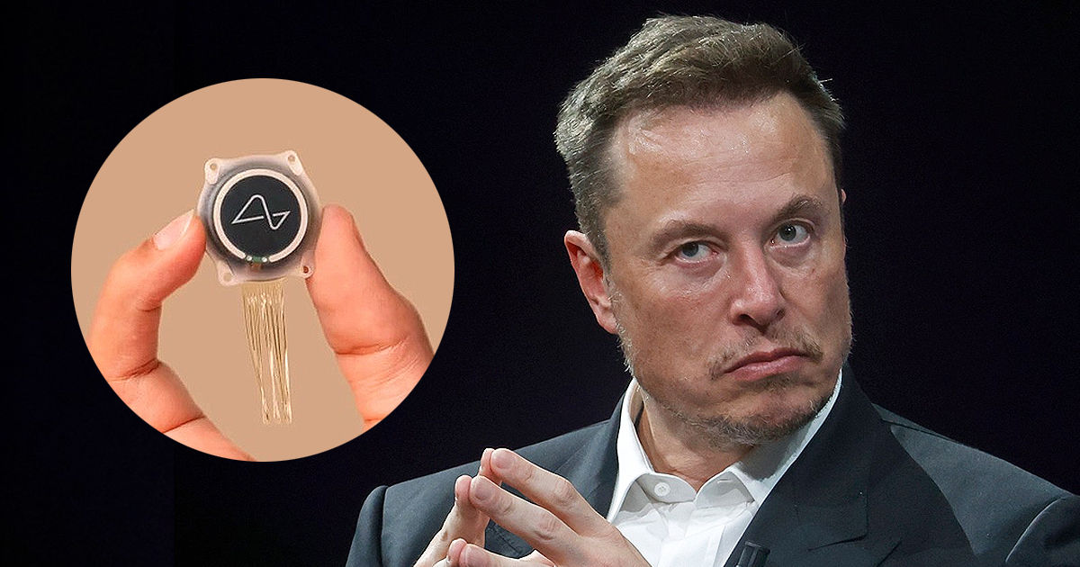 Илона Маска подозревают в сокрытии реальной картины с имплантатами Neuralink. Коллаж Point.md.