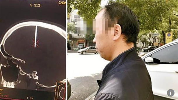 Китаец не заметил, как гвоздь пробил ему голову.