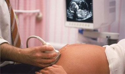 Noua lege le va permite femeilor să avorteze dacă sănătatea lor este pusă în pericol sau dacă au tendinţe suicidale.