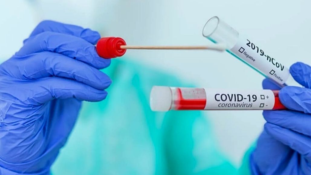 В Молдове зарегистрировали 1587 новых случаев COVID-19.