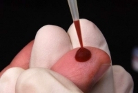 Cancerul este una dintre bolile care provoacă cel mai mare număr de decese la nivel mondial