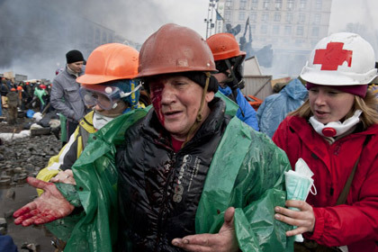 Всего, по данным ведомства, с начала беспорядков погибло 28 человек, 445 пострадавших обратились за помощью в медицинские учреждения. Фото: Piero Quaranta / AFP