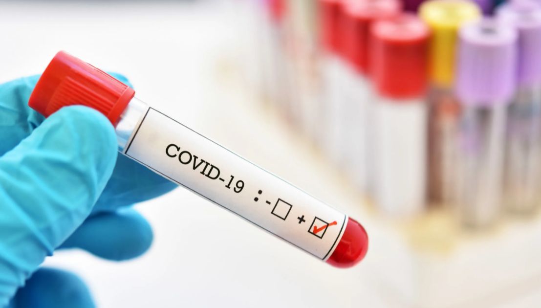 В Молдове зарегистрировали 368 новых случаев COVID-19.