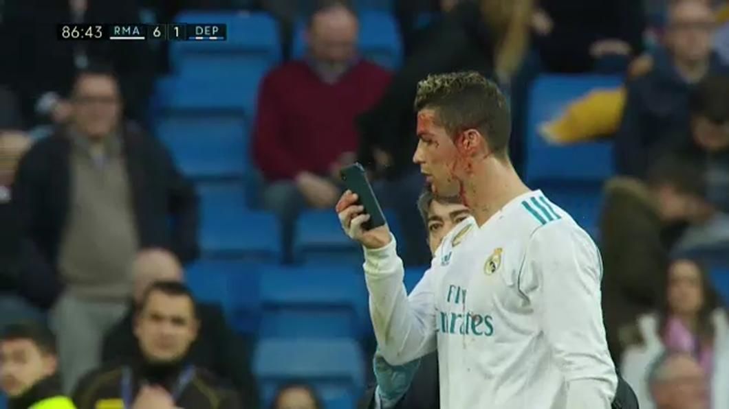Ronaldo, plin de sânge. Reacţia memorabilă când s-a văzut. Foto: digisport.ro