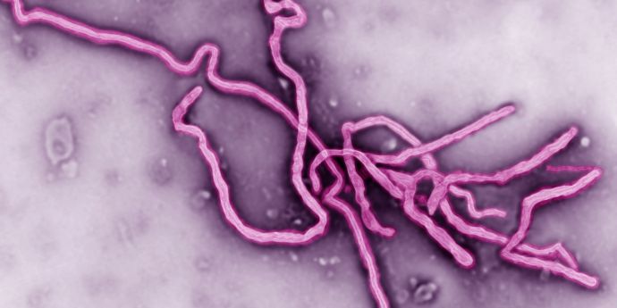 Pentru prima dată în ultimele luni, se raportează o scădere a numărului de cazuri de Ebola.