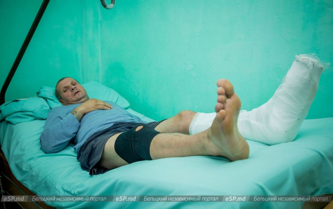 В результате аварии у мужчины пострадали обе ноги, одна из них сломана у стопы. 