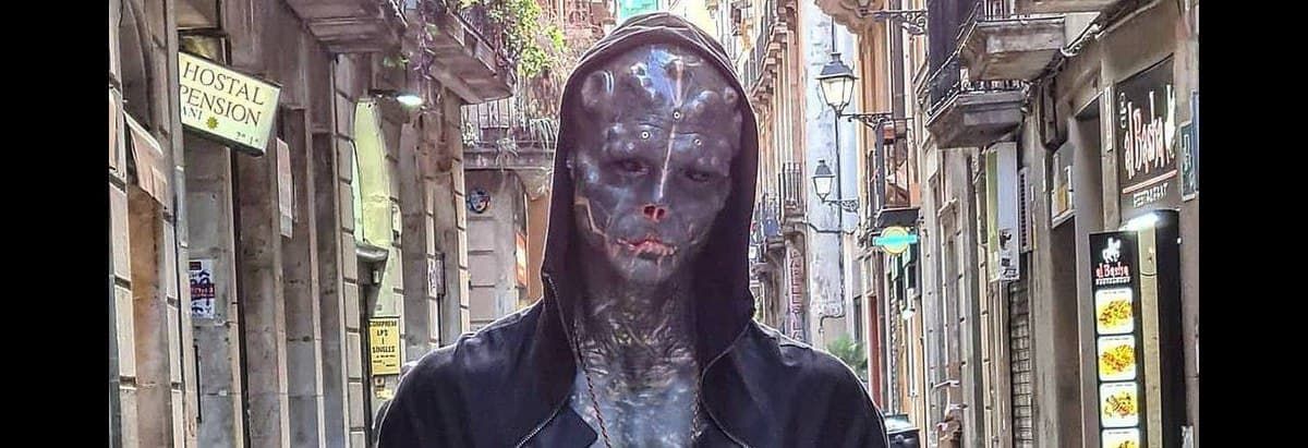 У парня из Франции уже нет ушей и носа, он отрезал себе еще и пальцы.