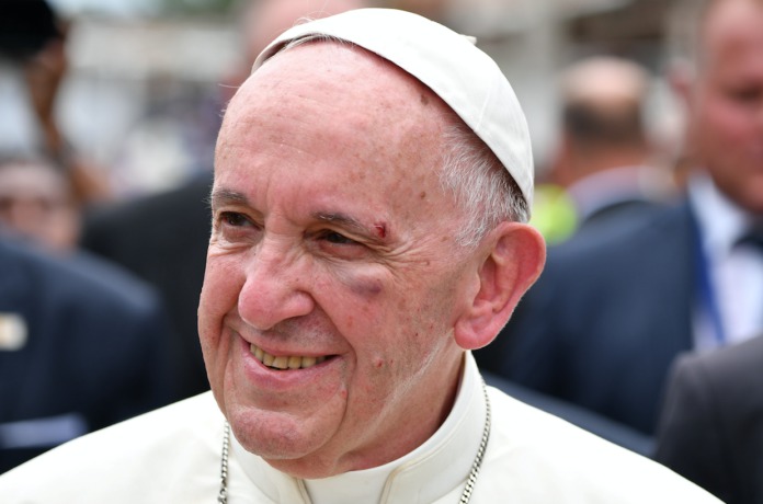 Papa Francisc, cu sprânceana tăiată şi cu vânătaie pe obraz în faţa mulţimii. Foto: news.ro