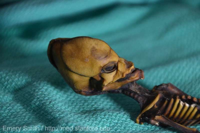 Mister elucidat în cazul scheletului din Chile, despre care s-a susţinut că ar fi de provenienţă extraterestră. Foto: med.stanford.edu