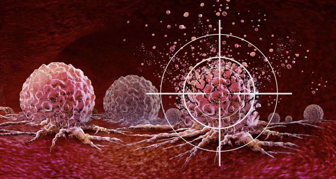 Cercetătorii au dezvoltat o imunoterapie care distruge cancerul metastatic.