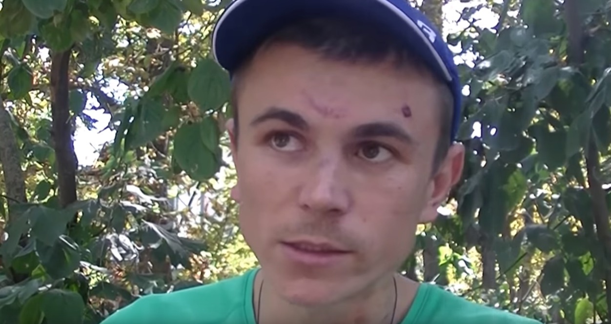 Bătut ca să retragă o plângere. Bărbatul acuză organele de drept de situaţia creată