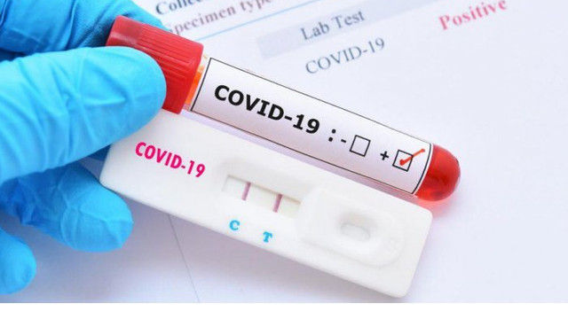 За неделю в Молдове зарегистрировано более 100 случаев заражения COVID-19.