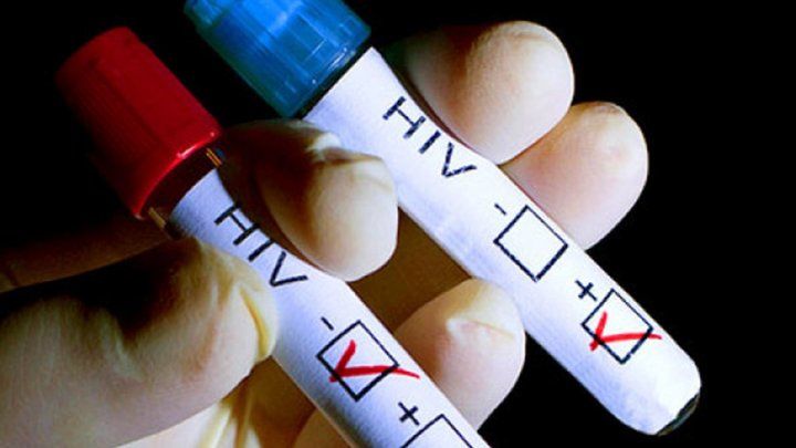 Un italian a fost condamnat la închisoare după ce a infectat cu HIV 30 de persoane
