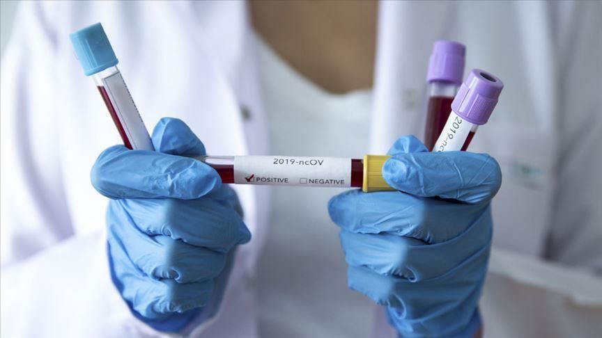 Специалист: Массовое тестирование на COVID-19 неэффективно. Фото: aa.com.tr.