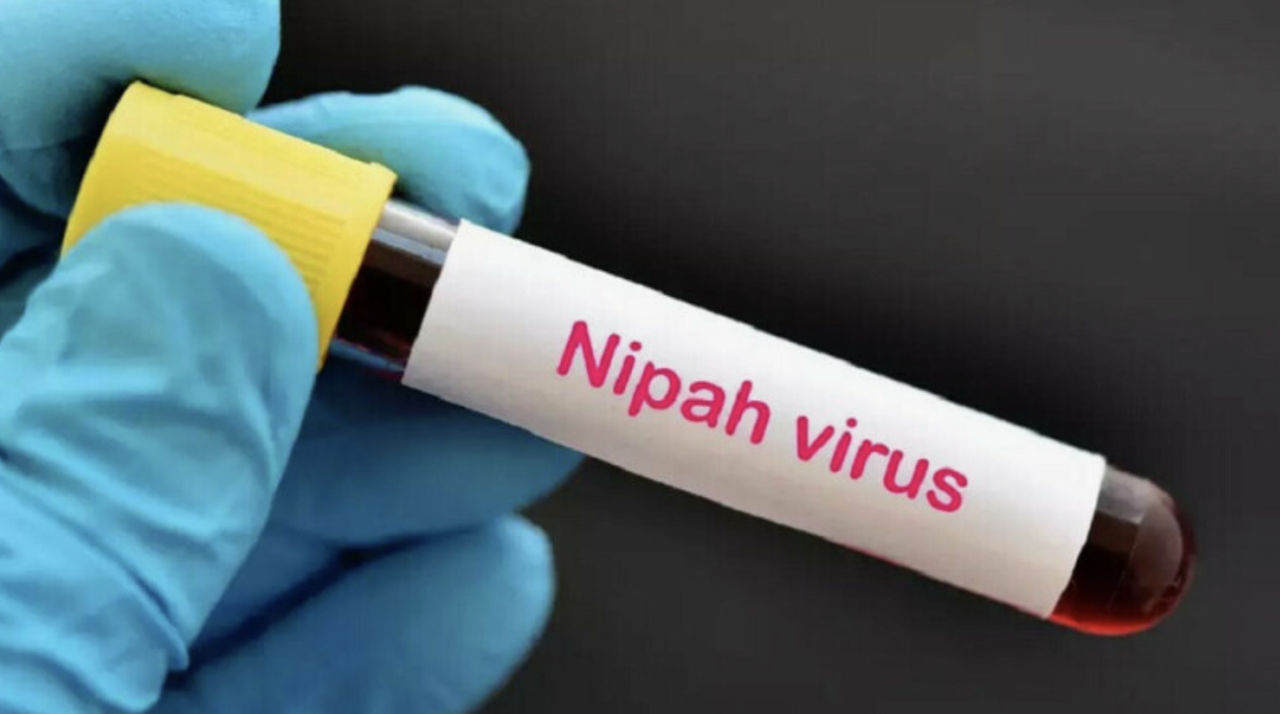 Medicii din Marea Britanie au emis un avertisment de călătorie cu privire la virusul Nipah.